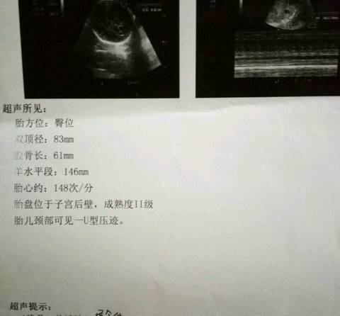 journal_insert_pic_642741271