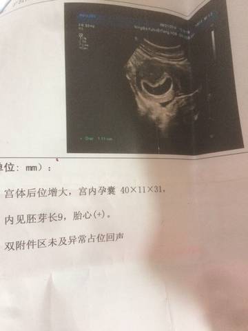 journal_insert_pic_644691634