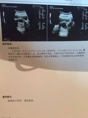 journal_insert_pic_645304904