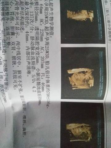 journal_insert_pic_646373727