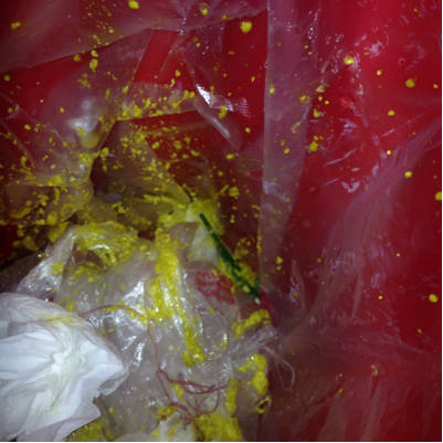 每次大便时都放1个响屁,屎1下子就出来了,拉的屎裏面都是黄色的1粒粒