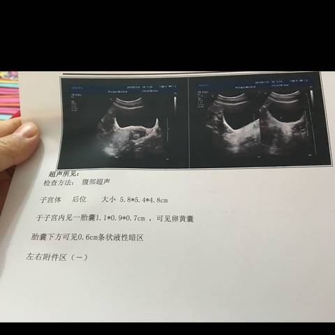 journal_insert_pic_647661531