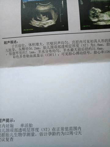journal_insert_pic_647498543