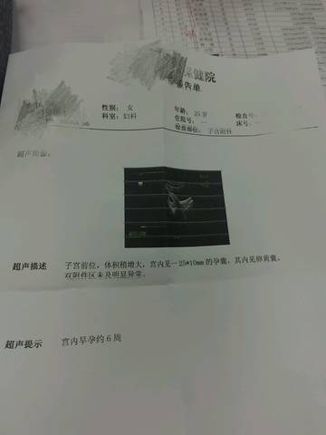 journal_insert_pic_650016960