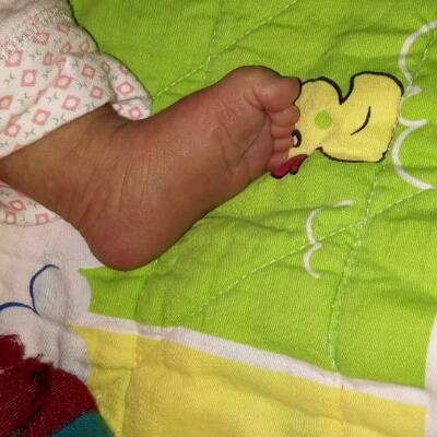 宝宝弓脚的照片图片