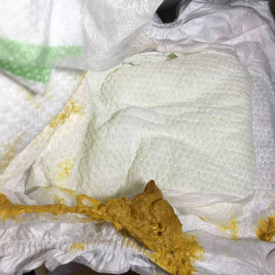 昨天宝宝就没粑粑,今天早上起来看见的就是这样的一坨,不知道是不是