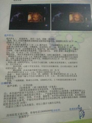 journal_insert_pic_651190751