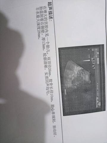 journal_insert_pic_651329838