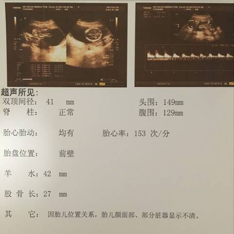 journal_insert_pic_655417829