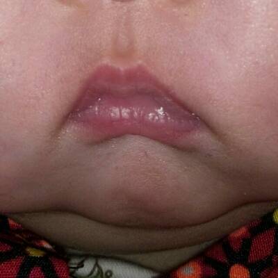 宝宝嘴唇跟泡的一样发白,舌头喜欢往外吐,有时伴有泡泡和口水,什麼