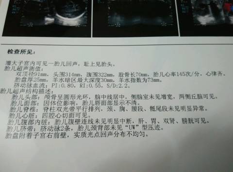 journal_insert_pic_659050434