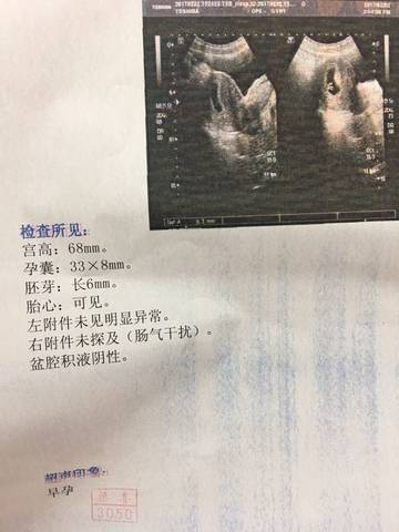 journal_insert_pic_660993532