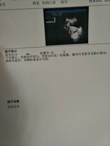 journal_insert_pic_664526170