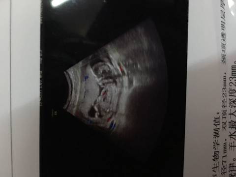 journal_insert_pic_664144202