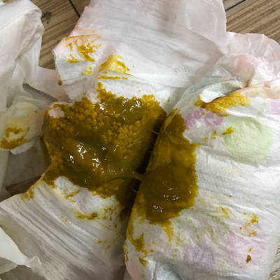 宝宝快三个月了,这两天拉粑粑有点黄绿色,有点稀,是怎麼了?有图