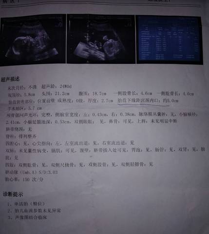 journal_insert_pic_667888658
