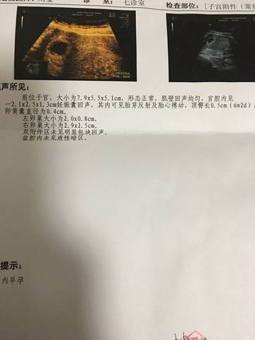 journal_insert_pic_667640274