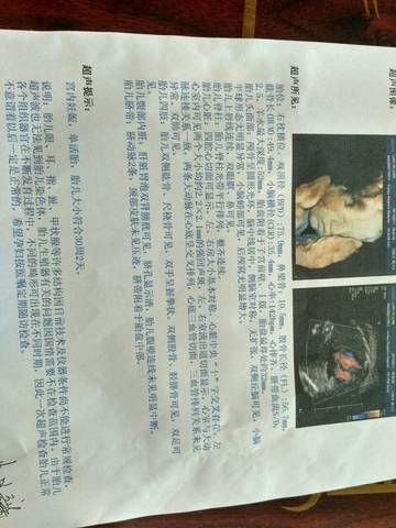 journal_insert_pic_668320872