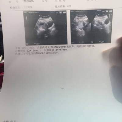 journal_insert_pic_672659291