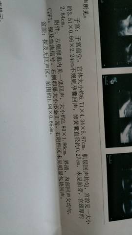 journal_insert_pic_673760775