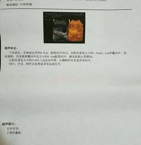 journal_insert_pic_674495608
