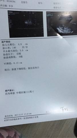 journal_insert_pic_674723323