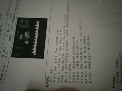 journal_insert_pic_674947242