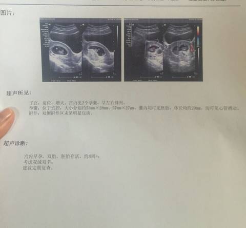 journal_insert_pic_675353448