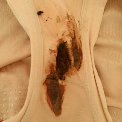 下午洗完衣服,上厕所发现流血了,不知道怎麼回事?怎麼办?