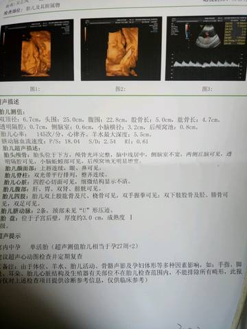 journal_insert_pic_683370820