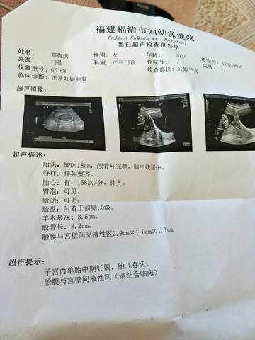 journal_insert_pic_683533230
