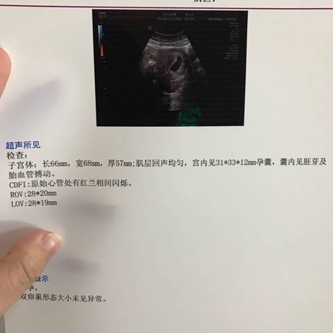 journal_insert_pic_684878644