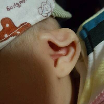 婴儿垂耳长大的图片图片