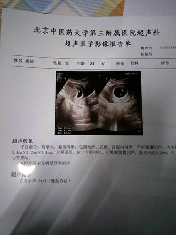 journal_insert_pic_686759428