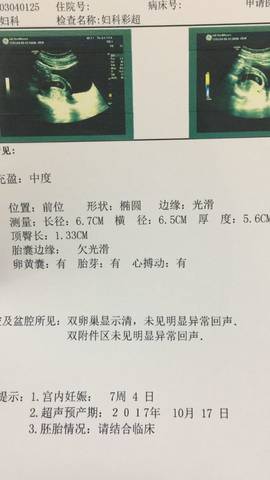 journal_insert_pic_686316746