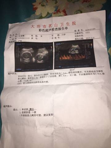 journal_insert_pic_687682772