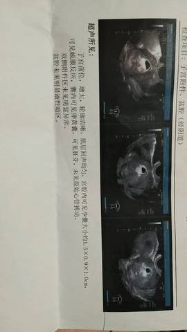 journal_insert_pic_688399934