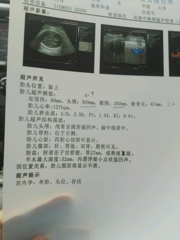 journal_insert_pic_688211296