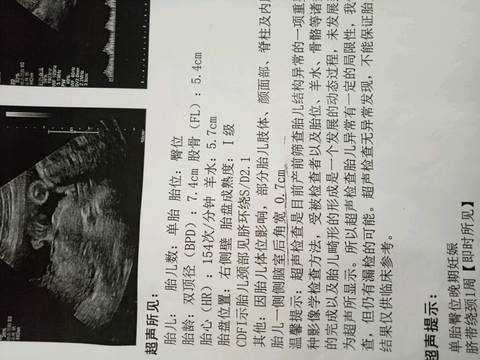journal_insert_pic_688870852