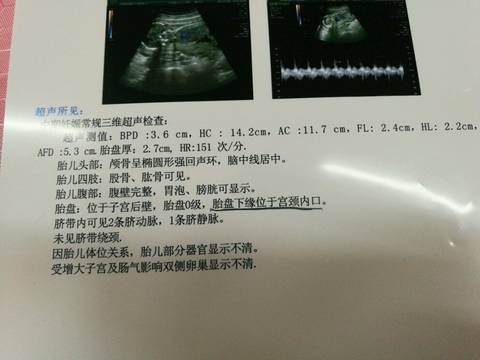 journal_insert_pic_688782630