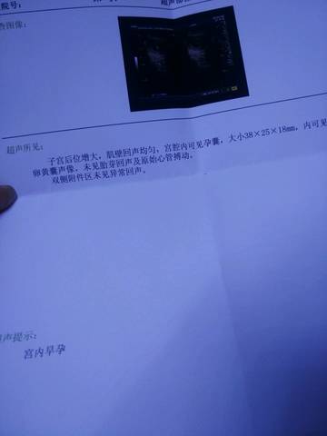 journal_insert_pic_689701690