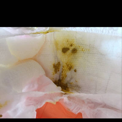 残忍拒绝 推荐回答              新生儿一天七八次大便是正常的 再大
