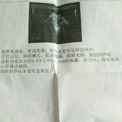 journal_insert_pic_690899867