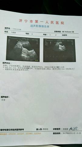 journal_insert_pic_691315778