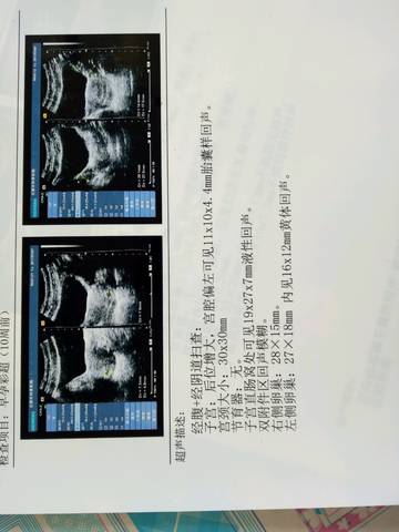 journal_insert_pic_691690728