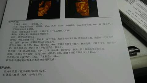 journal_insert_pic_692497982
