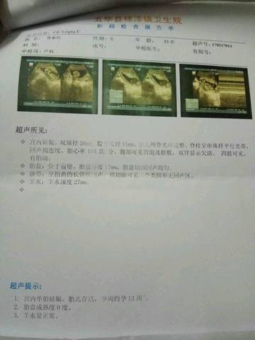 journal_insert_pic_692906578