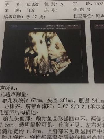 journal_insert_pic_692925474
