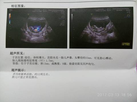 journal_insert_pic_692851936