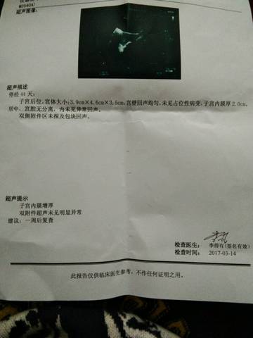 怀孕6周 B超照不到孕囊 宝宝树